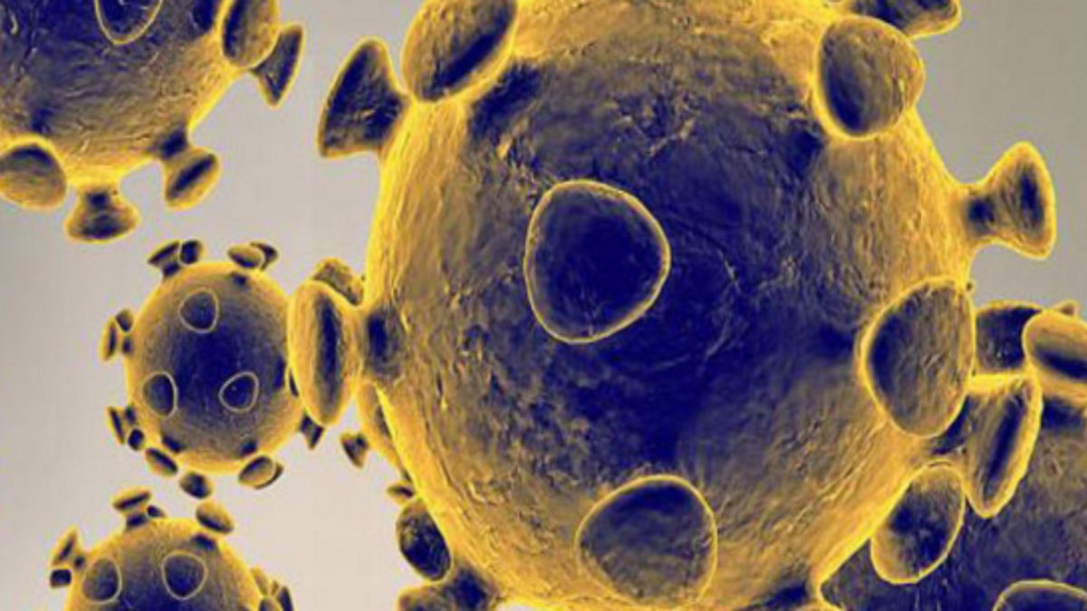 DOD partners with defense industry to mitigate impacts from COVID-19, Contractor&nbsp;dies